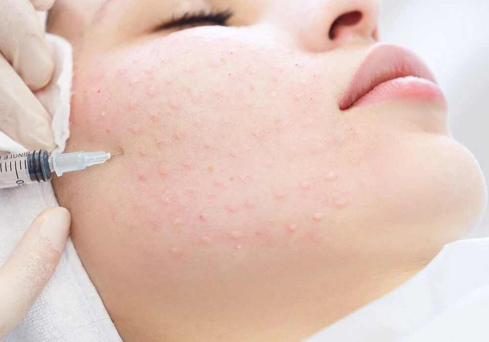 nutricion facial con vitaminas