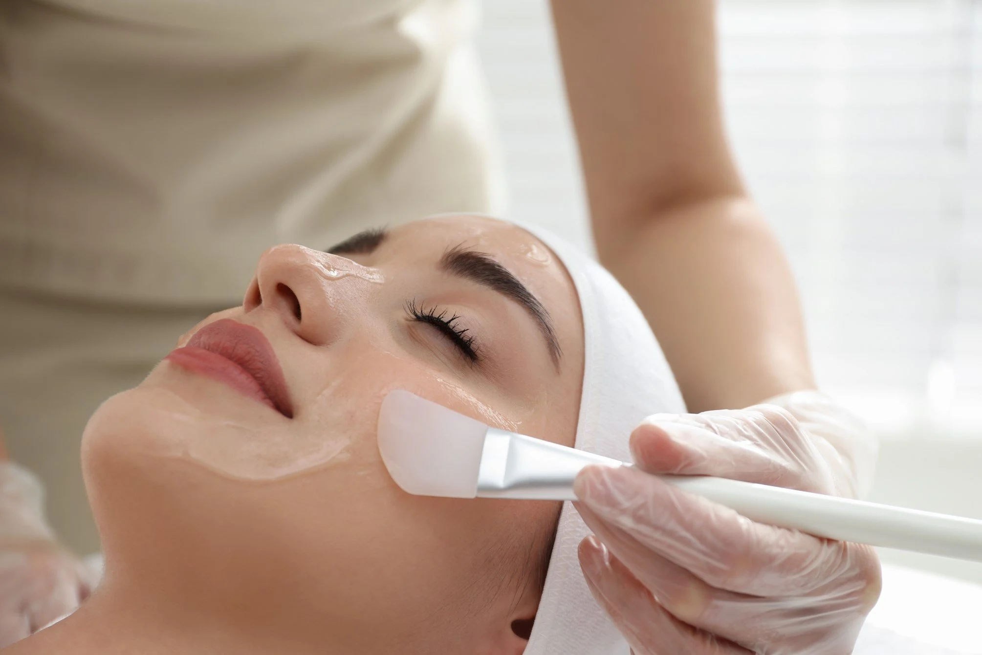 peeling quimico facial en medellin