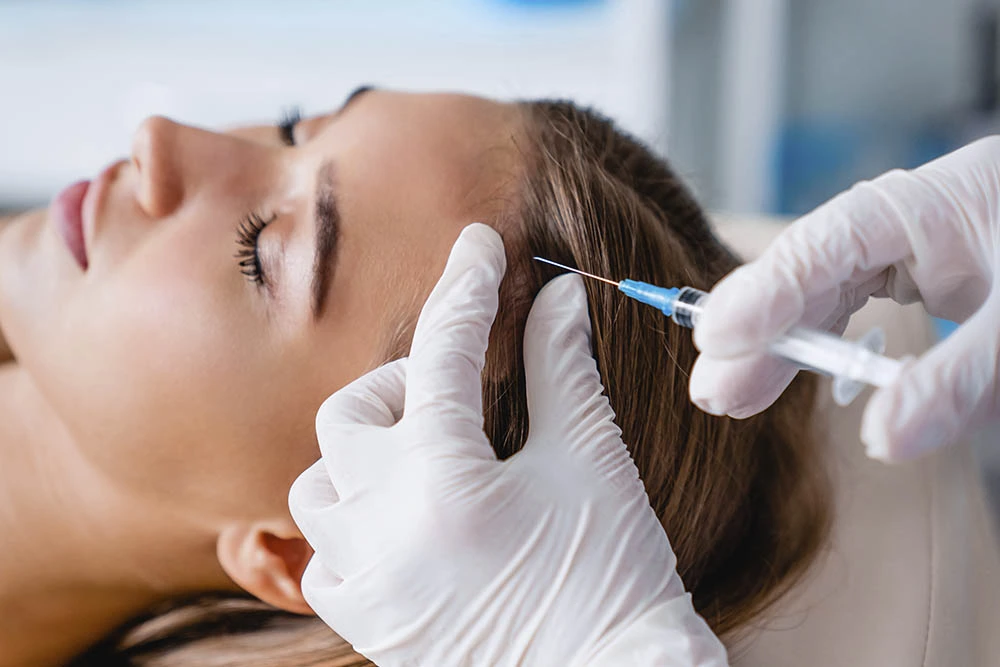 plasma rico en plaquetas para el cabello